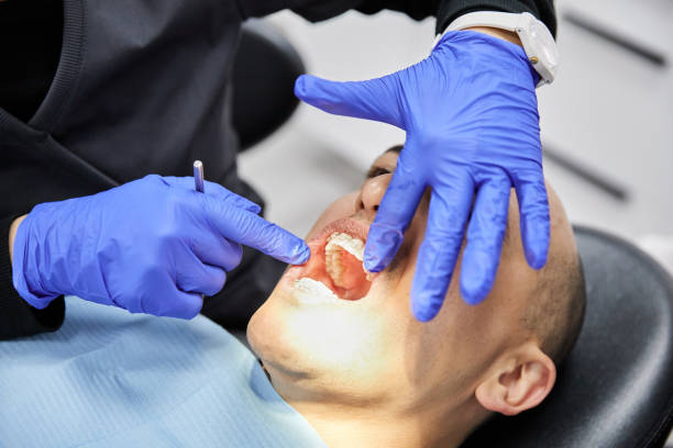 Best Knocked-Out Tooth (Avulsed Tooth) Treatment in Cambridge, MA
